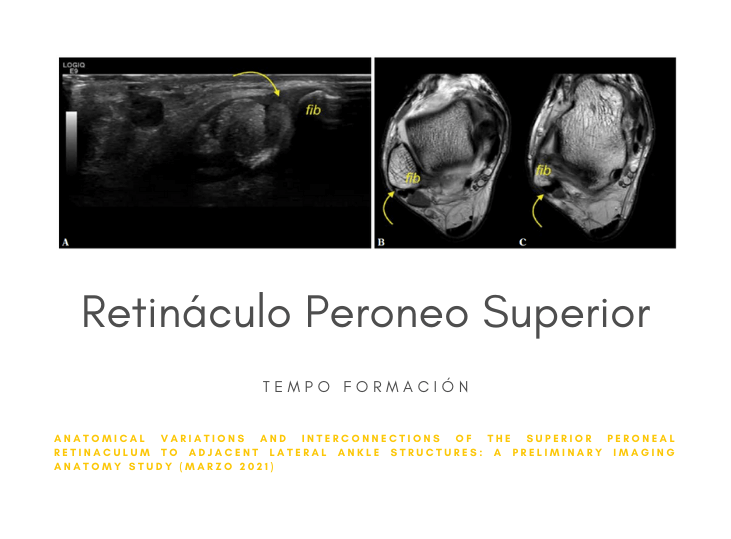 retinaculo-peroneo-variantes-anatomicas